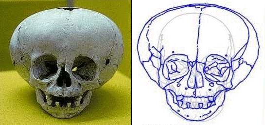 skull from Ica(Peru) and Merida(Mexico)